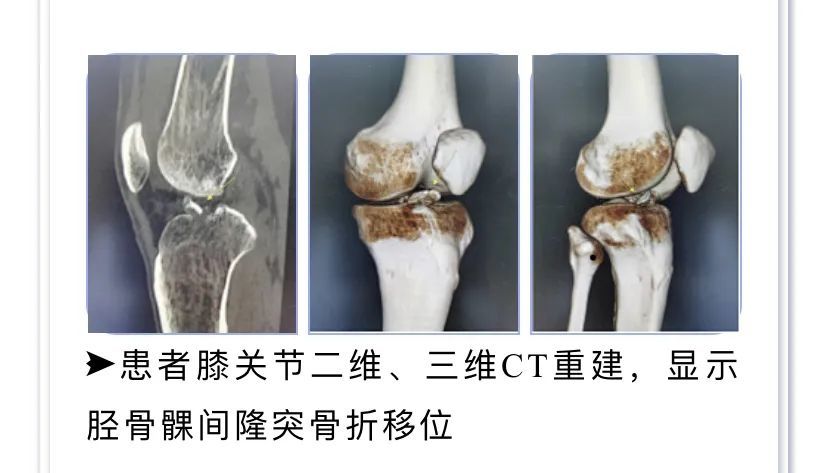 疫情|隔离人员急需手术怎么办？苍南县医护人员“重装”上阵