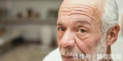 染发剂|已经变白的头发还能变黑吗营养师调理每天多吃3种食物可养发