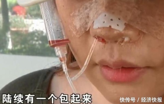 女子高价整容,脸上挂满“注射器”,医院:赔你点吧
