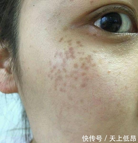人理|家中没人理的它,每天拿来抹抹脸,便能轻松祛斑,使皮肤白皙光滑