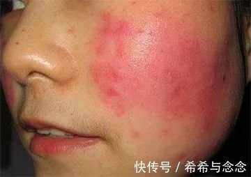 宝妈|垃圾国货护肤品排行榜!百雀羚、完美日记上榜,小众孕妇款却真香