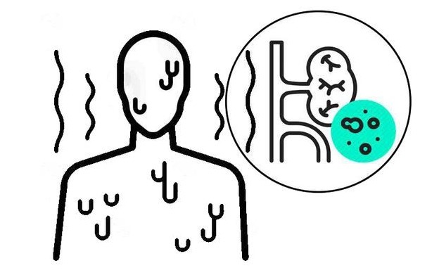 肾脏|尿毒症不是突然到来,医生忠告:身体出现这4种症状,千万别拖!