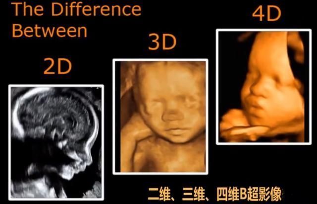 家人|产检时让医生不耐烦的询问,准妈妈和家人却很关心,你问过哪个?