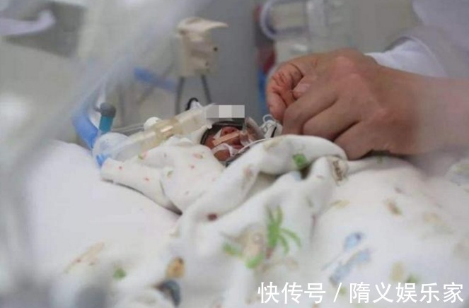 阿米利娅|世界上最小的婴儿,放在手心比巴掌还小,现在变成了这个样子