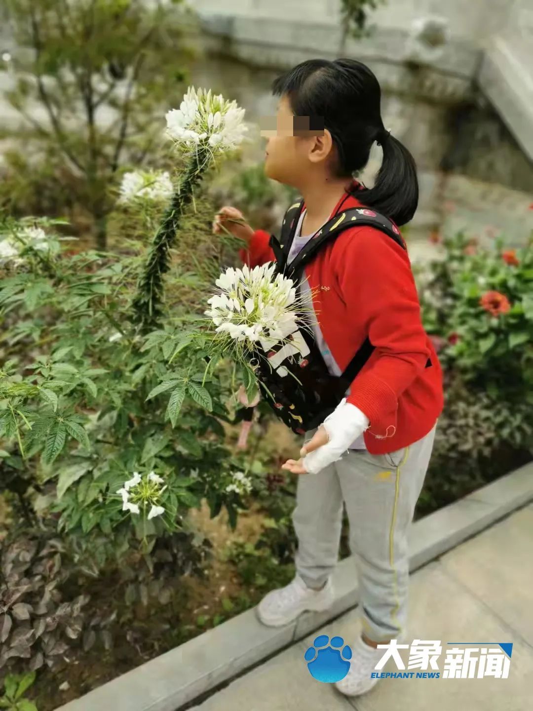 恶性肿瘤|甘肃10岁女童患国内罕见恶性肿瘤,全国仅2台治癌利器却无法使用