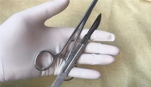 肿瘤|癌症多长时间不复发,算是治愈了?医生给出3个标准,你达标没?