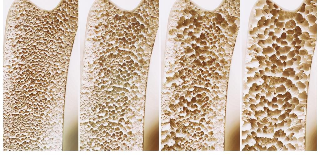 秘诀|108岁老人，骨龄似58岁，长寿秘诀不是多运动，而是这3件事