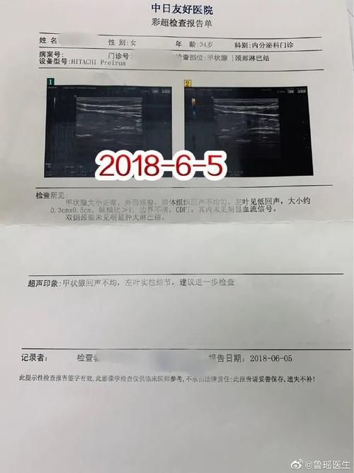 B超怀疑甲状腺结节恶性，甲穿提示为良性，基因检测到有突变，到底是“良性”还是“恶性”？