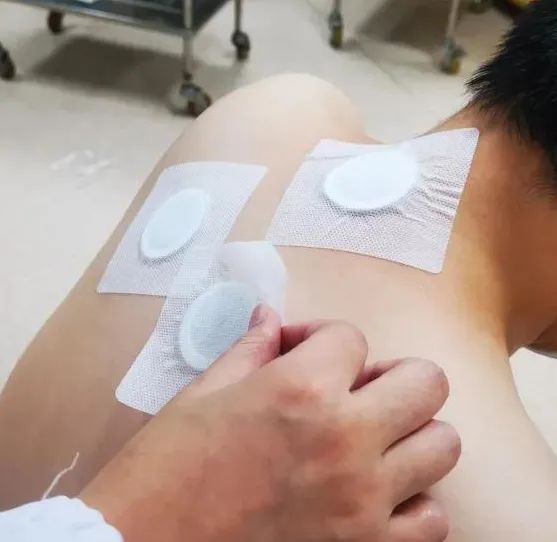 三伏贴|注意！三伏膏这么贴易受伤！69岁女子后背红肿，走路都痛