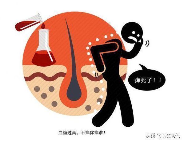 血糖值|睡觉时有三种表现的人,建议你,尽快测下血糖,别等糖尿病找麻烦