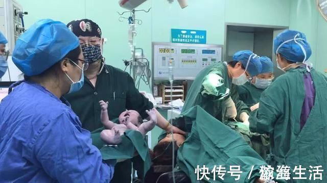 顺产|产妇顺产开十指宫口有多大?带你了解真相,看完泪目:为母则刚