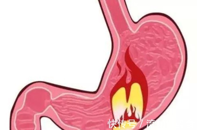 癌变|从“炎症”到“癌症”需要用多久提醒三种炎症尽量不要拖延