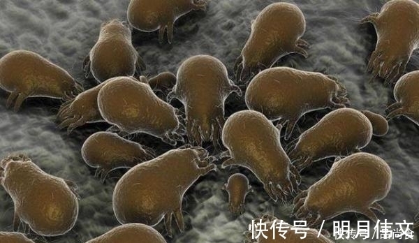 床上螨虫太多?教你3个不要钱的“土法子”, 把螨虫“赶尽杀绝”