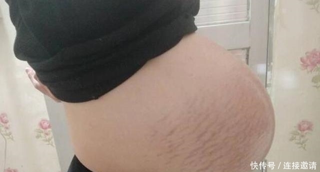 怀孕|孕妇悬垂肚走红,头一次见到这种肚型,网友至少双胞胎吧