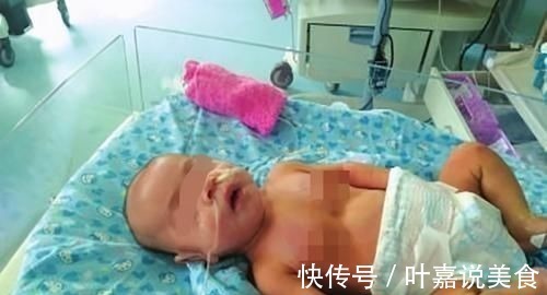 父母|五个月女婴双肾长满结石,只因刚出生三天,父母就开始做这件事