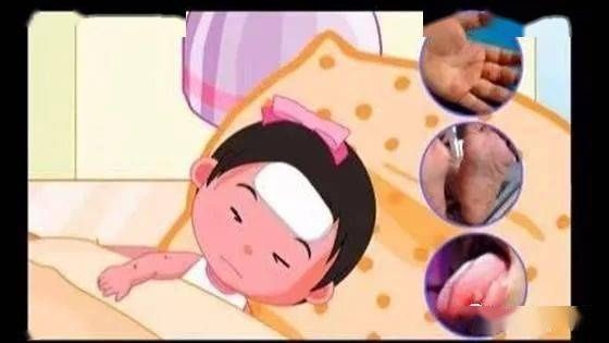 预防手足口病、你我共参与