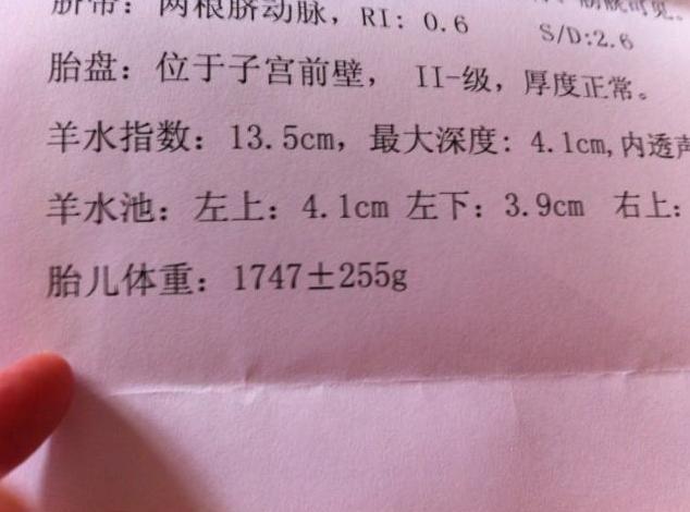 小琴|孕期严守八杯水还是发现羊水偏少,得知原因后,孕妈感到惭愧