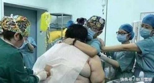 胎儿|产妇孕期胃口惊人致重度肥胖,当胎儿出生那刻,整个医院都乱套了