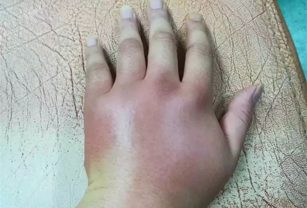 五脏六腑|长寿密码就在手上！五脏六腑历历在“手”，男左女右，秘密都在这