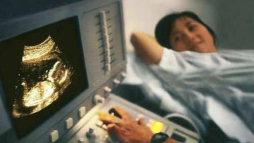 静怡|怀孕后,为何有人一直吐,有人却从不吐原因和腹中胎儿有关