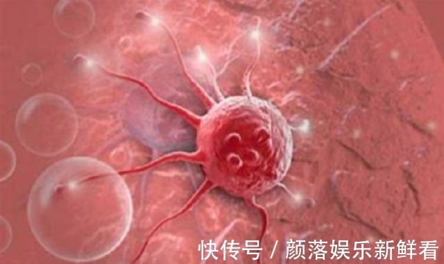 治疗|有钱才可以保命,李宗伟抗癌3年花费近千万,做33次质离子治疗