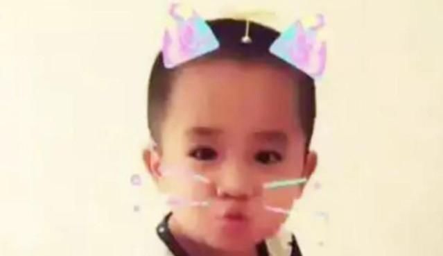 妈妈|4年了,哪个因喝奶太用劲,被妈妈用剪子戳脸的男宝宝现况怎样