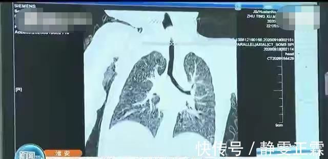 婴儿|粗心家长喂食八个月婴儿排骨,导致窒息婴儿命悬一线