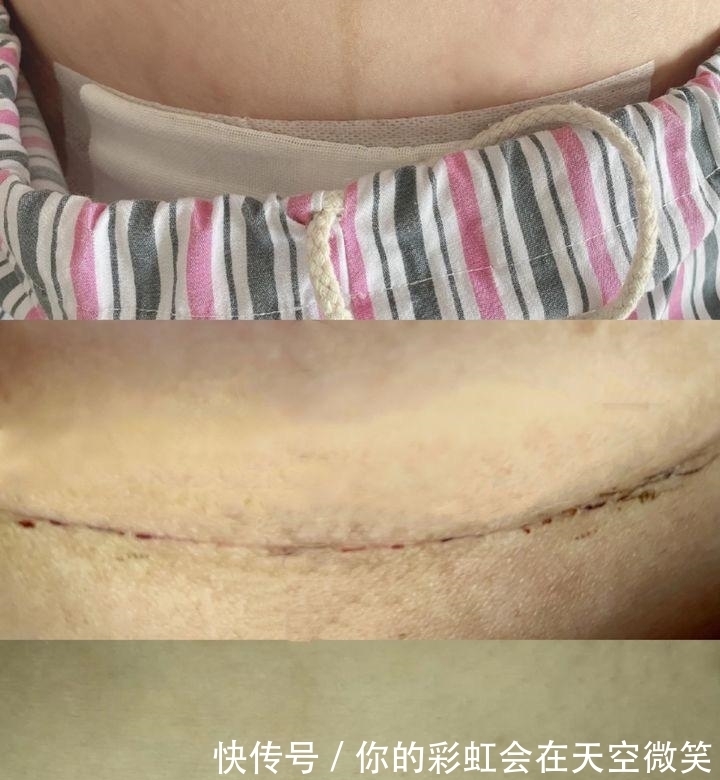 收腹带|入院待产包清单,收藏起来一定能用到