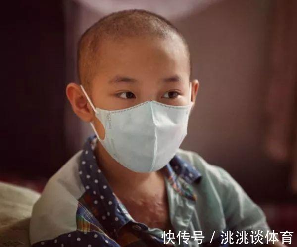 催熟|超市里4种水果,含有大量甲醛,诱发白血病,不要再给小孩吃了