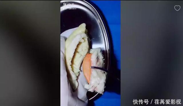 王醫生|32歲醫生竟給水果做手術？一夜吸粉12萬！網友：“我的膝蓋跪爛了”