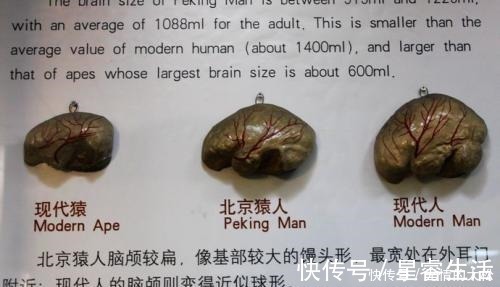 智力|孩子脑袋大就聪明？影响孩子智力的其实是这3样，家长别被骗了