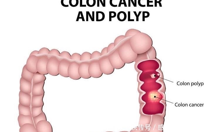 男性|男人体检查什么?这7项一年做一次,求个安心!