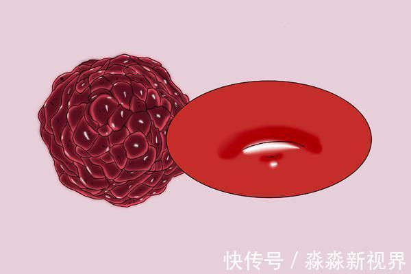 肿块|假如一个人得了癌症,身上其实是有信号的,晚上就会有3点异常