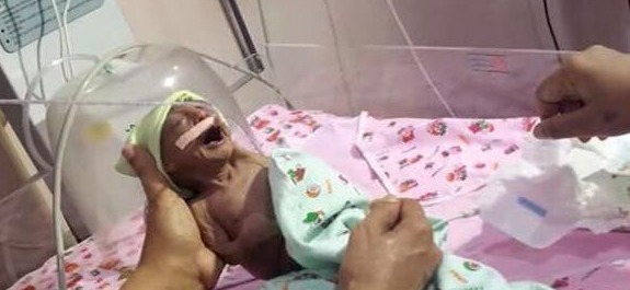 迪利|母亲生下宝宝,奇丑无比狠心抛弃,爷爷喂奶抚养长大创造奇迹