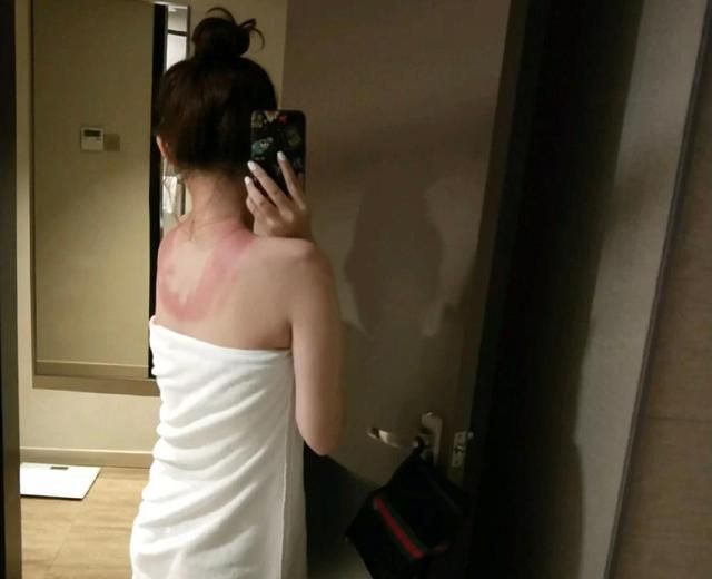 夏日|女生夏日护肤,比防晒更重要的是:晒后修复!这才是“变黑”原因