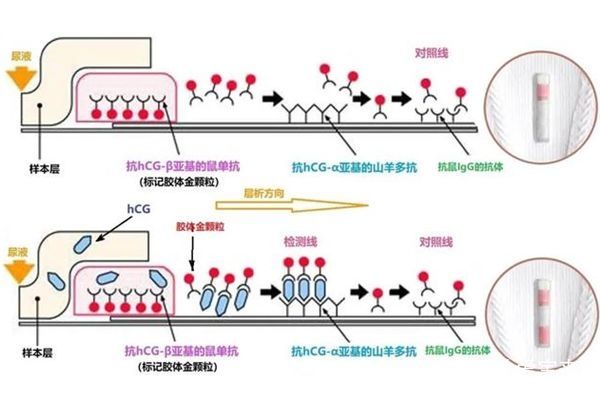 宫外孕|解析孕期HCG值的相关知识