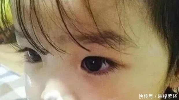 青春期女生如何让眼睛“变大变美”坚持3招，班花不教教我