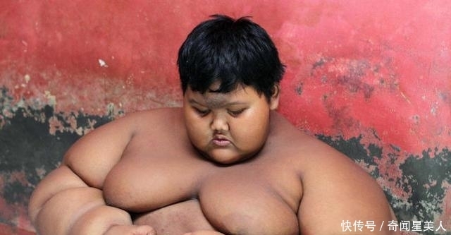 男孩|曾经那个世界最胖的男孩!体重384斤,减肥152斤后变帅小伙