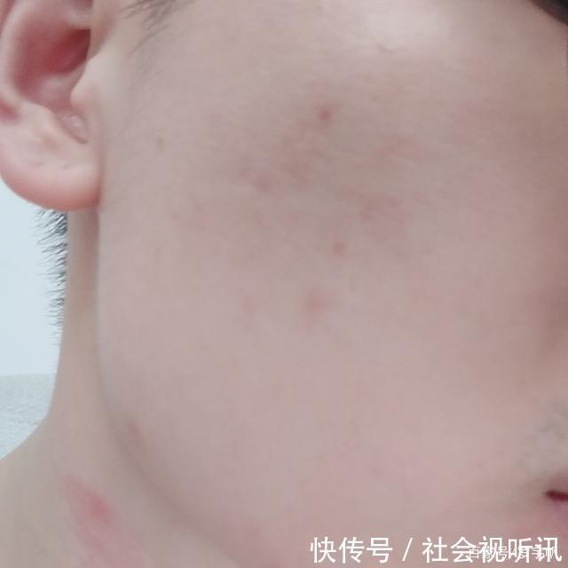 越来越多|国货护肤品最厉害的领域不是美白、不是抗老,而是修护皮肤屏障