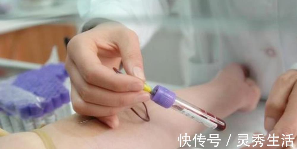 b超|怀孕期间,产检时4种结果“异常”,可能是胎儿智力出现问题了