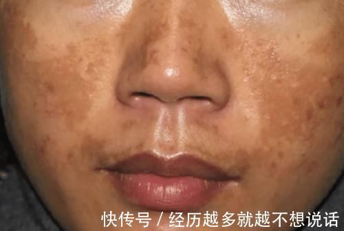 肝毒|养肝“加油站”被发现，不是菊花，敞开吃，肝脏恢复年轻状态