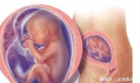 胎儿|胎儿在妈妈肚子里也会缺氧,会这样小心的“提醒”妈妈
