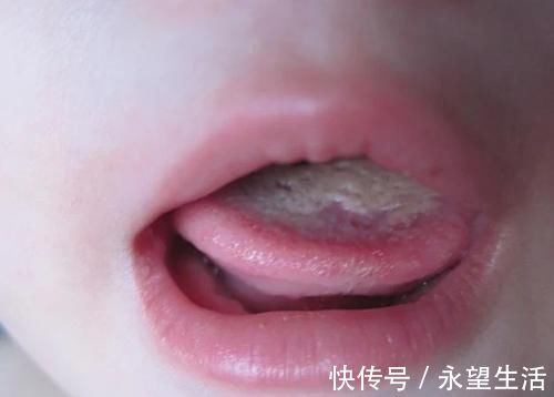 发育期|孩子不发育,身体或有几个信号传出,儿科:做好3事,帮助长个子