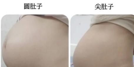 怀孕|肚子长毛、有黑线?怀孕后肚子的这几点变化最明显