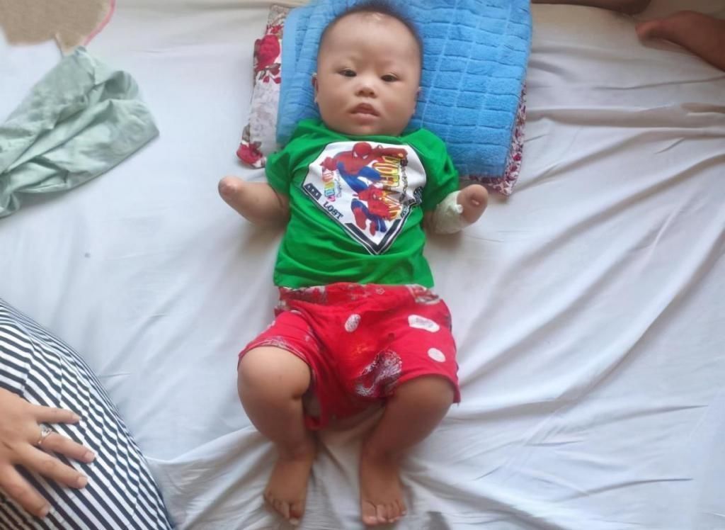 产检|孕妈十次产检,医生每次都说胎儿正常,娃出生后妈妈差点哭瞎双眼