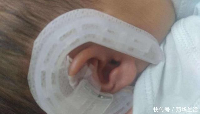 丹丹|按时产检却生下“畸形儿”这些问题检查时很难发现,孕妈要知道