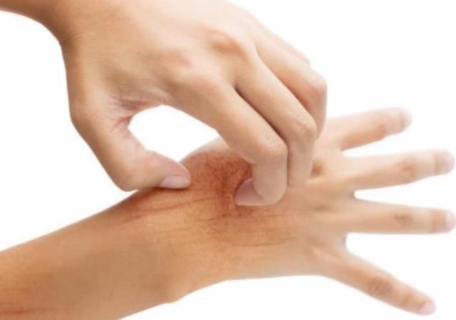 宁心安神|血糖升高的时候,睡觉时一般会出现3种现象,尽量学会自查