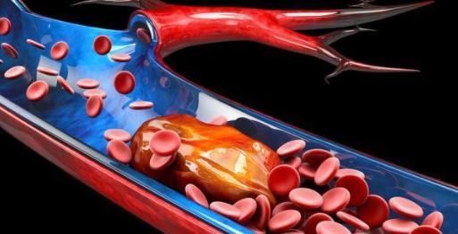 血压如何控制血管才不会爆裂?忠告:血压失控