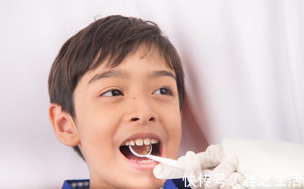 矫治|儿童做牙齿矫正三个最佳时间:家长要牢记,矫治越早干预效果越好