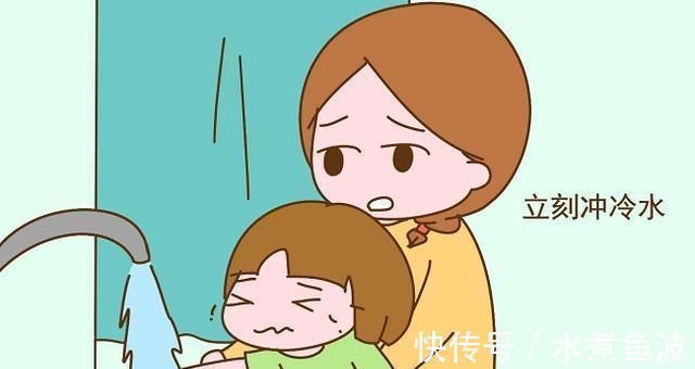 安全意识|2岁女娃被开水烫伤腿,爸爸的机智举动救了娃,医生赞:做得很专业